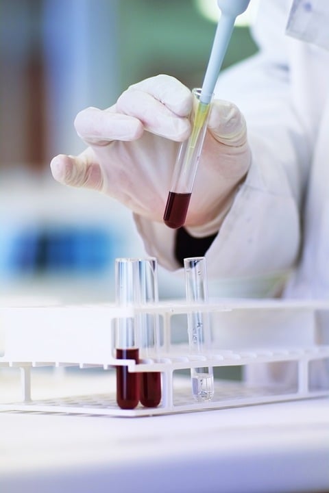 Biochemistry | Best Diagnostic Center in patancheru
