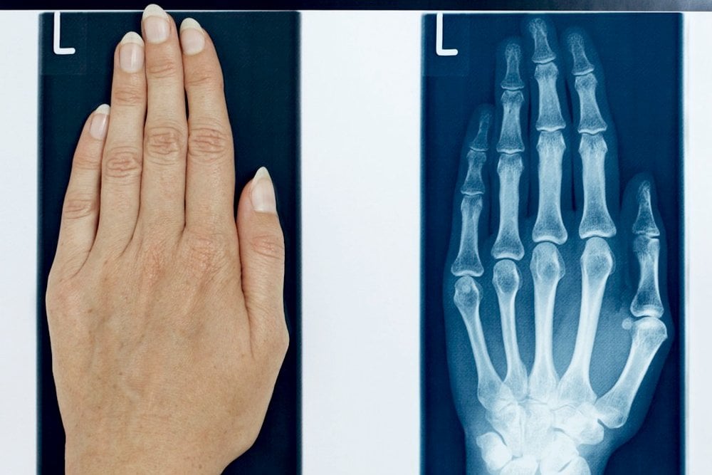 x ray | Joy Scans | X ray centre near patancheru | diagnostic centre near me