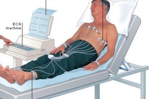 Heart-attack-diagnosis-and-treatment Heart-attack-diagnosis-and-treatment