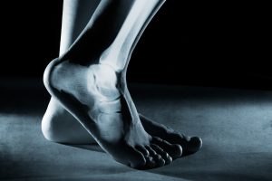 Human foot ankle and leg in x-ray Human foot ankle and leg in x-ray