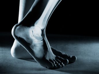 Human foot ankle and leg in x-ray